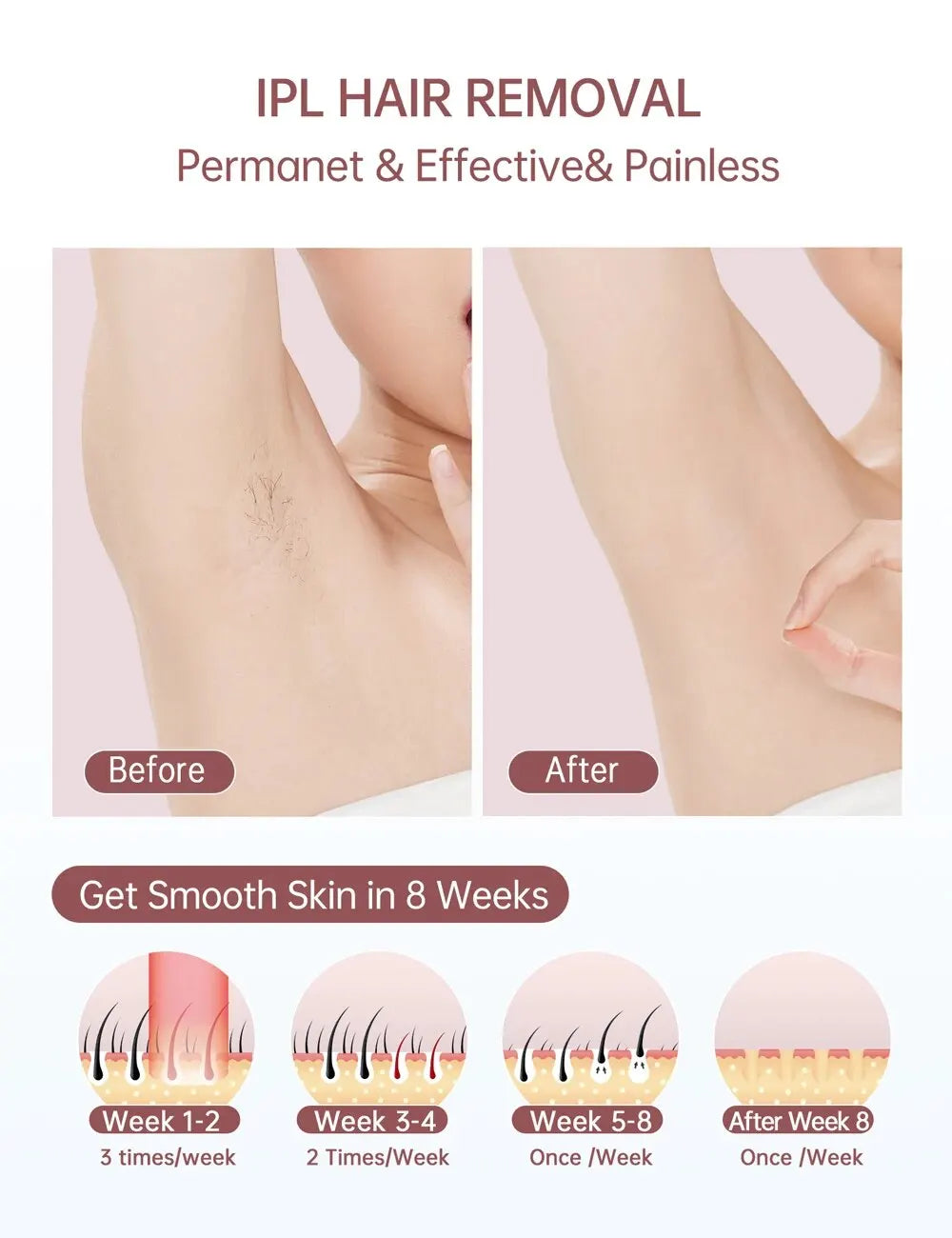 Laser Hair Removal Ice Cooling - 999900 Flashes At-Home Permanent Painless Whole Body IPL Hair Removal Device for Women Men - Digital Edges | Online Electronics Store